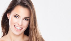 conventional orthodontics salou tarragona