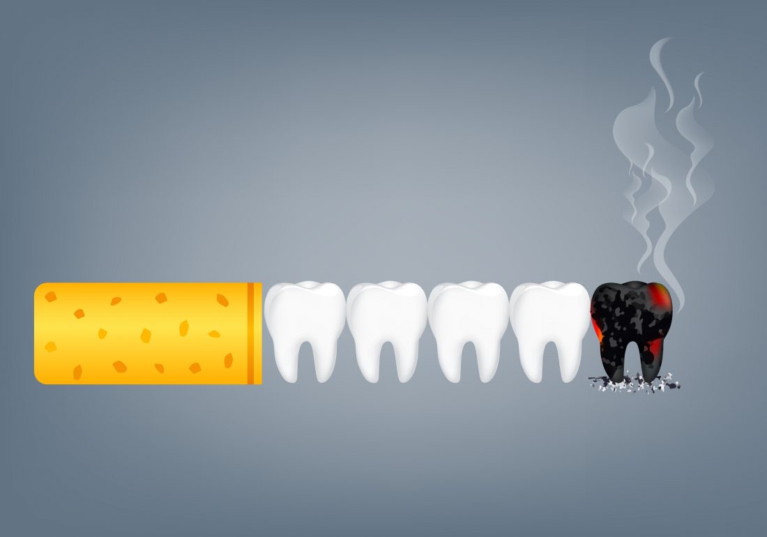 Smoking affects dental implants