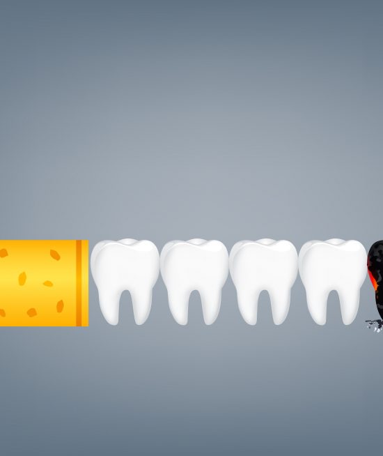 Smoking affects dental implants