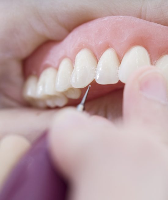 Pròtesis dentals, com es classifiquen?