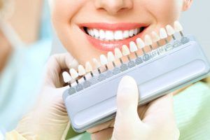 diseño de sonrisa en Salou y Tarragona; estética dental en Salou y Tarragona; Skyn Concept en Salou y Tarragona.